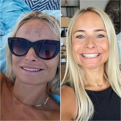 Gummy Sun Skin Shield